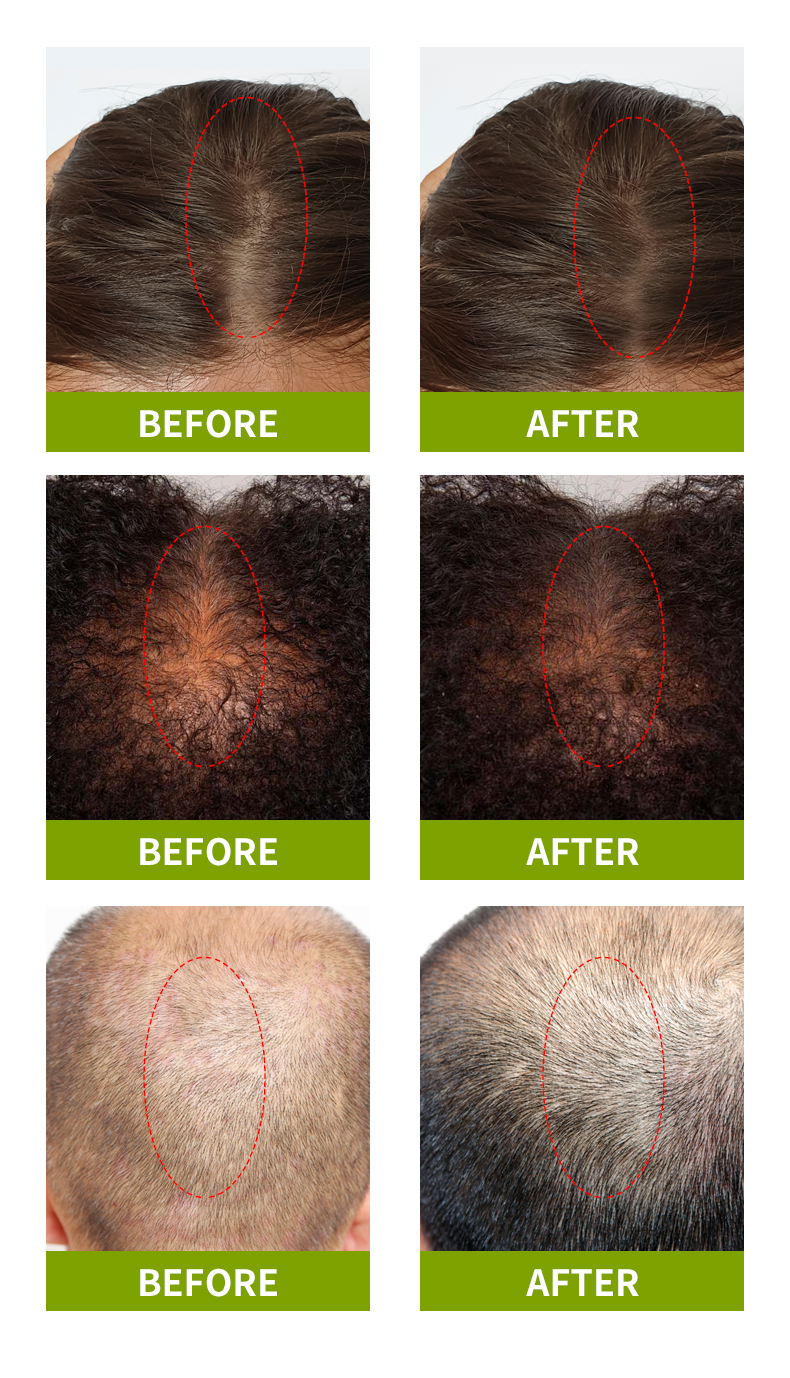 草本护发油_07 Сюлли草本护发油_08 