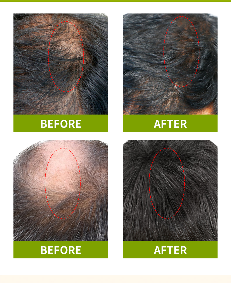 Сюлли草本护发油第二版_08