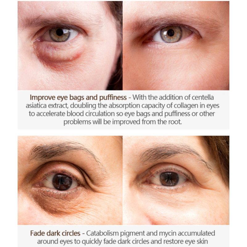 Индивидуальный крем для глаз против морщин с аппликатором (2) 